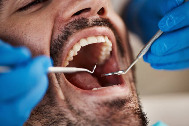 Best Dental Abscess Treatment in West Park, FL
